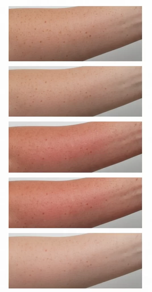 Neglecting Body Exfoliation Neglecting Body Exfoliation